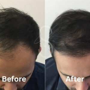 Before-1.jpg