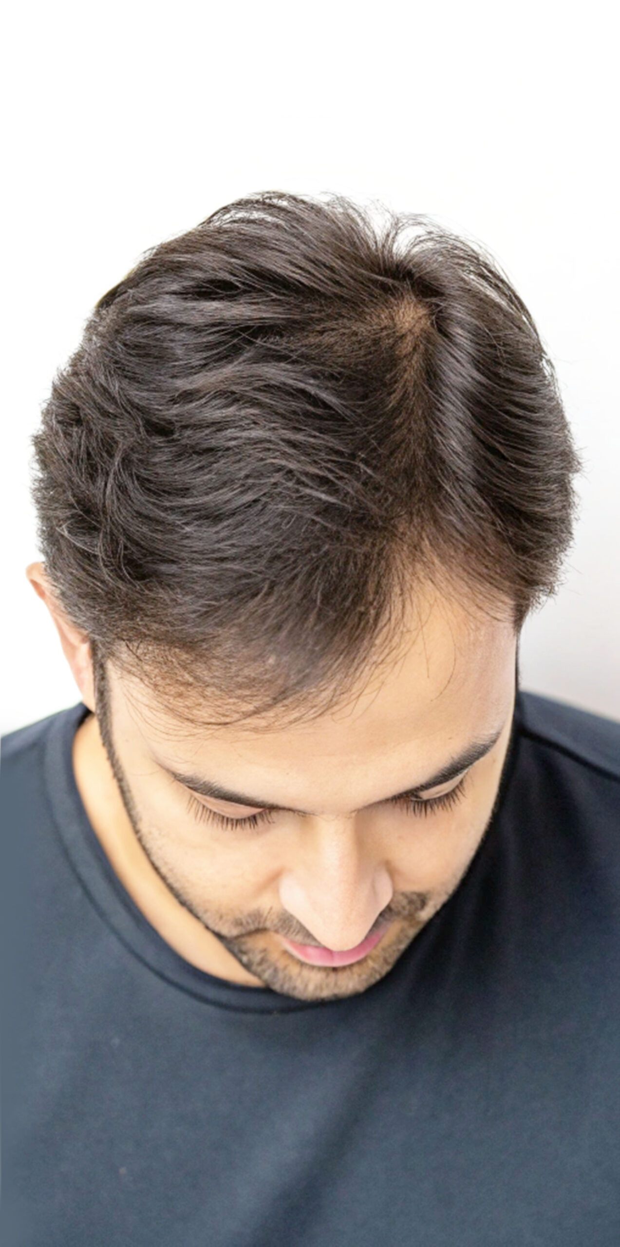 Comparison image 2.1