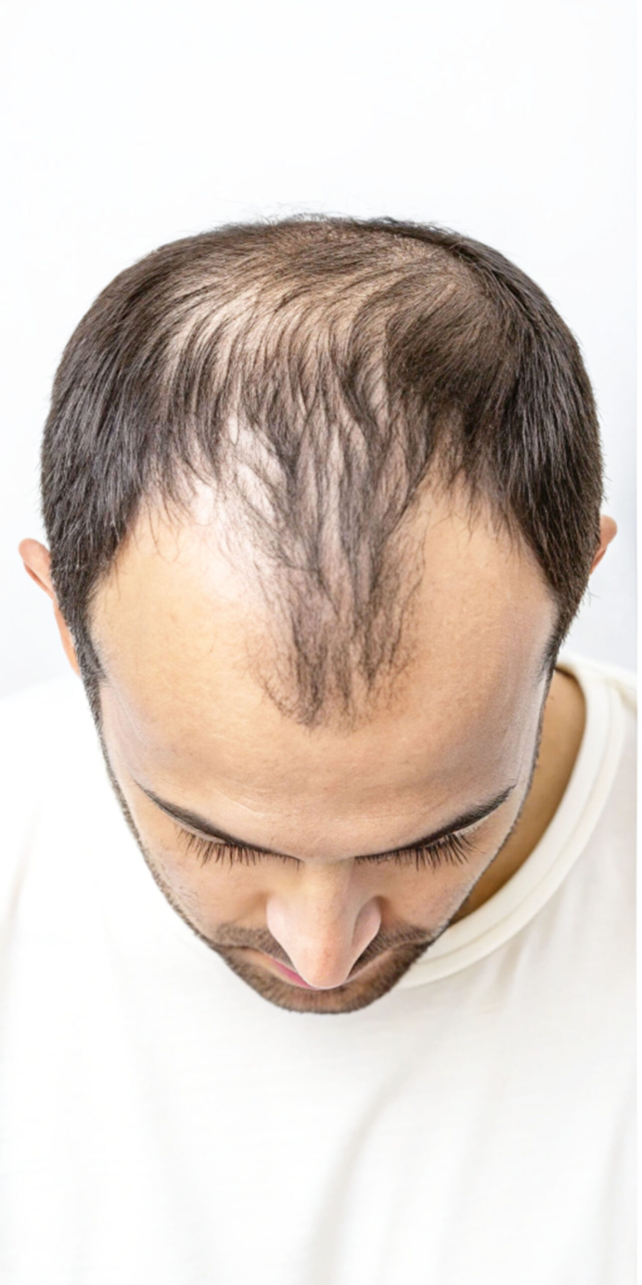 Comparison image 2 Comparison image 2