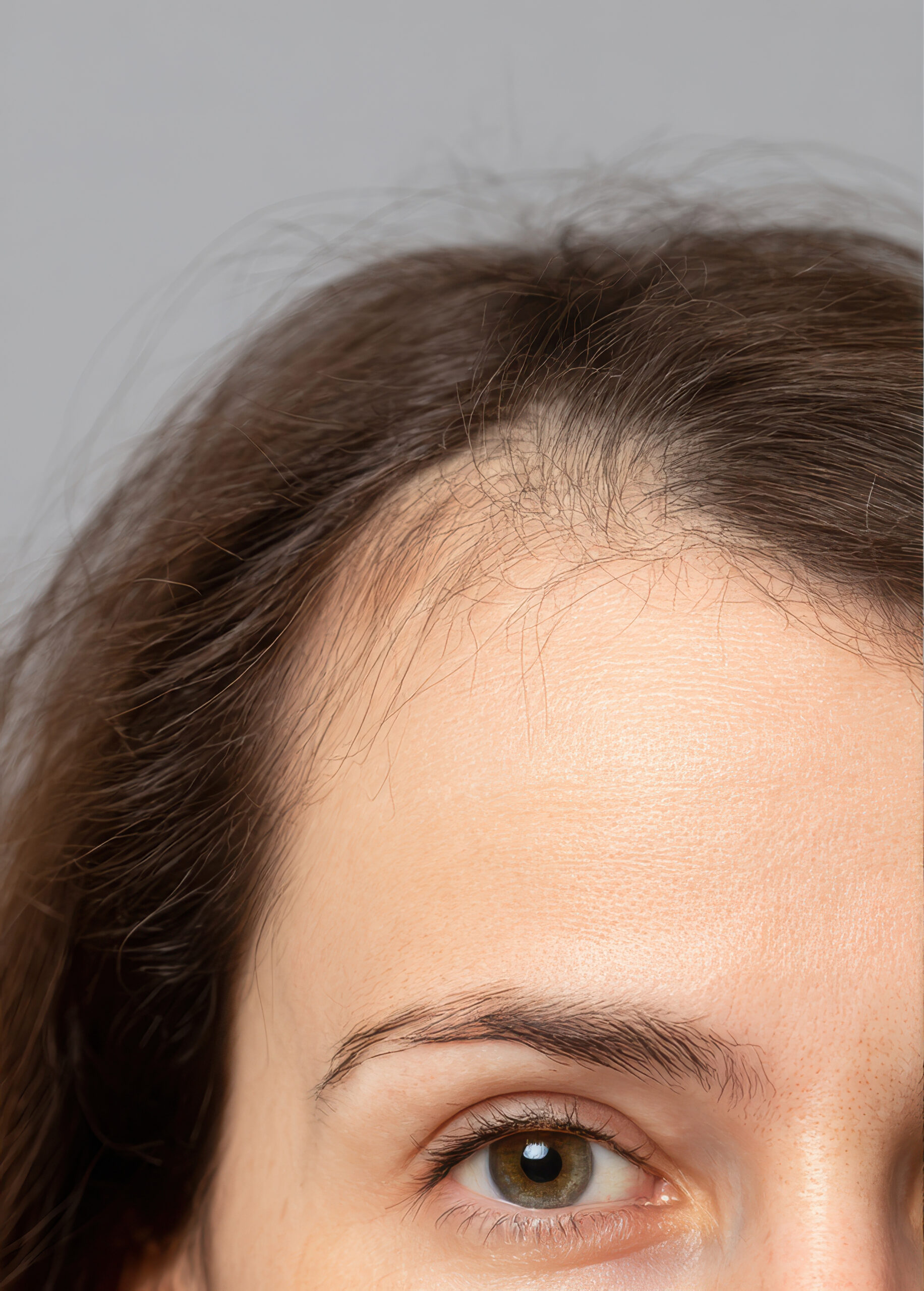 Comparison image 3 Comparison image 3