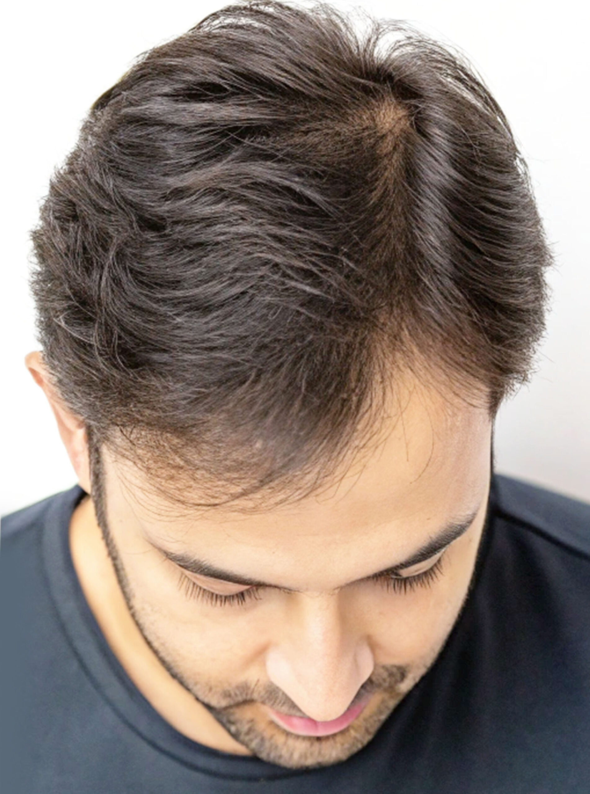 Comparison image 2.1.jpg