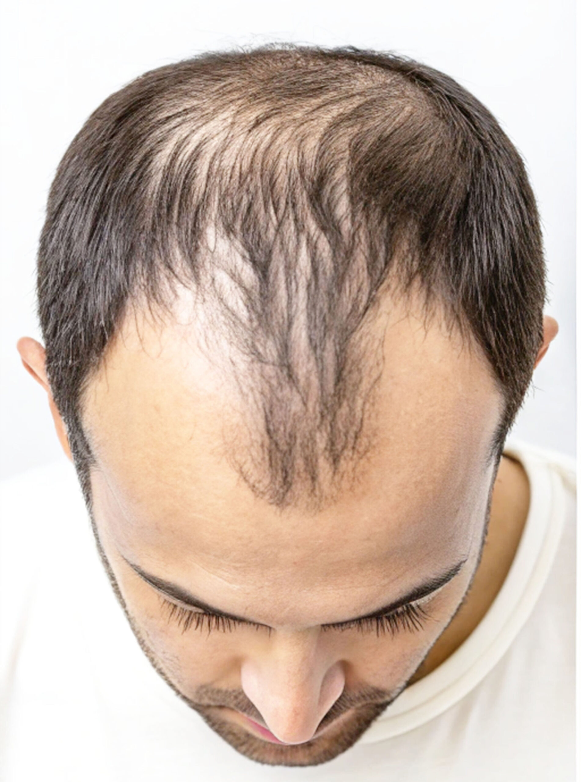 Comparison image 2.jpg Comparison image 2.jpg