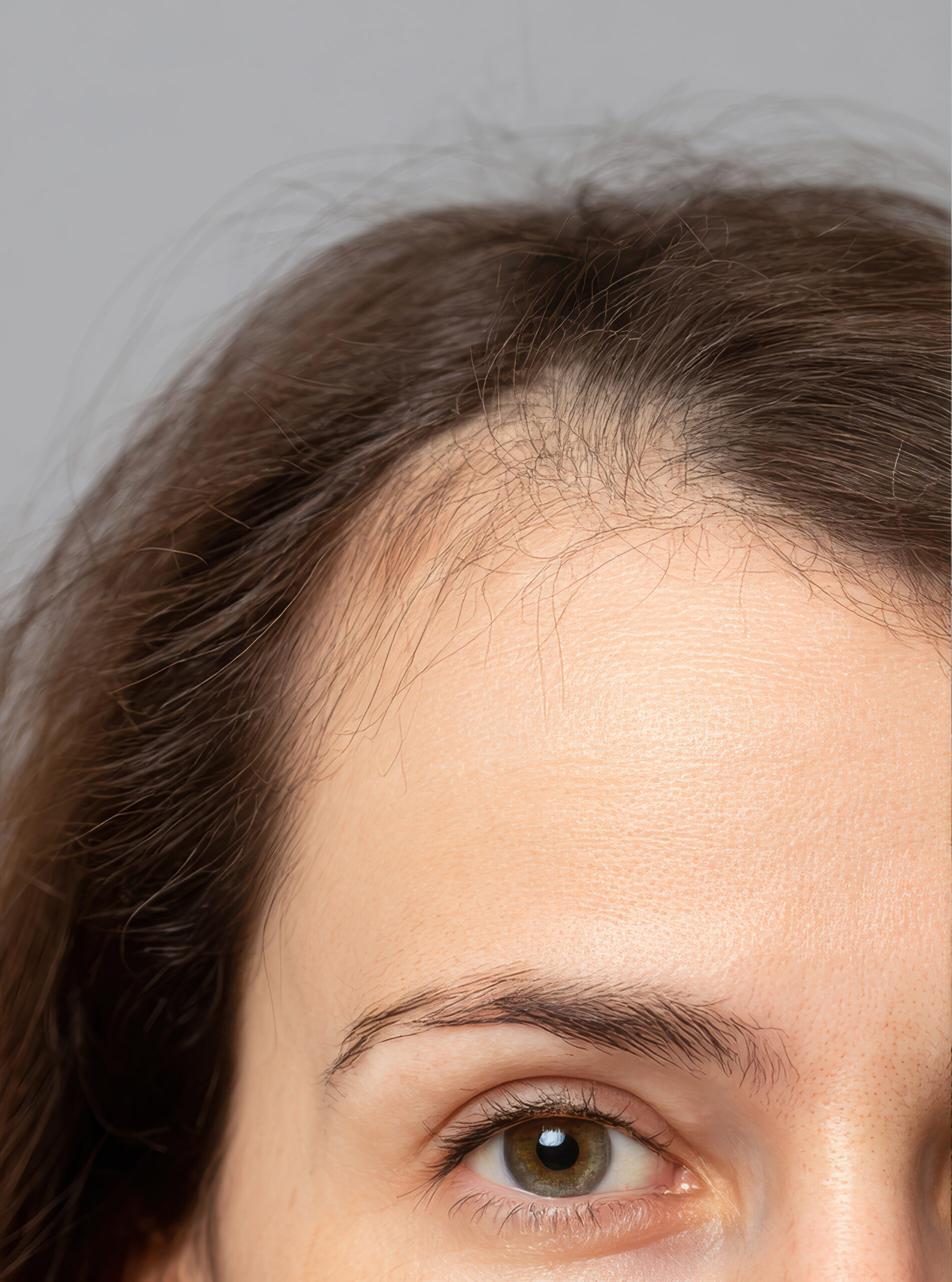 Comparison image 3.jpg Comparison image 3.jpg